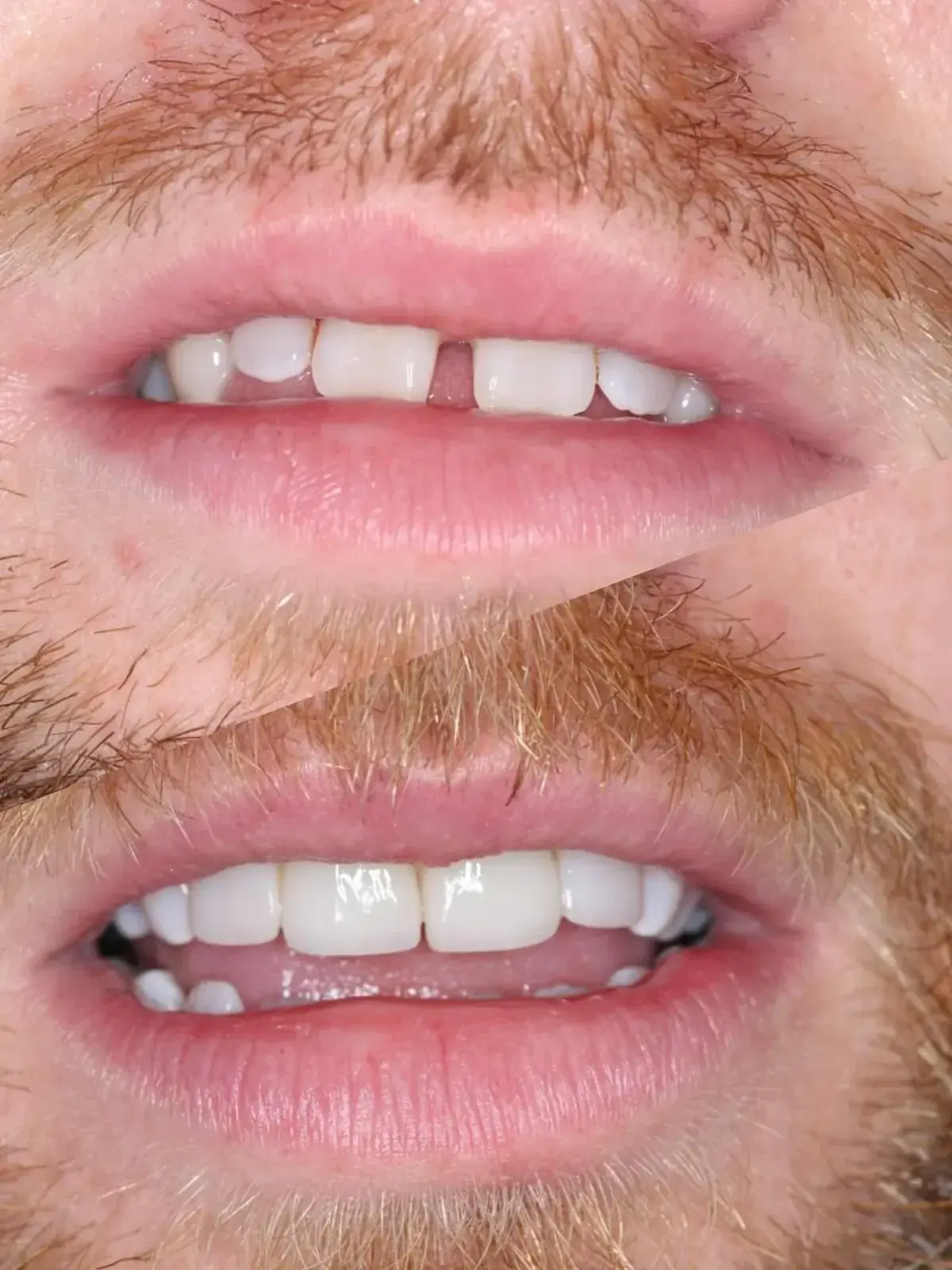 Caso de éxito estética dental en Miraflores 1